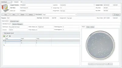 Microbial Limits Tests